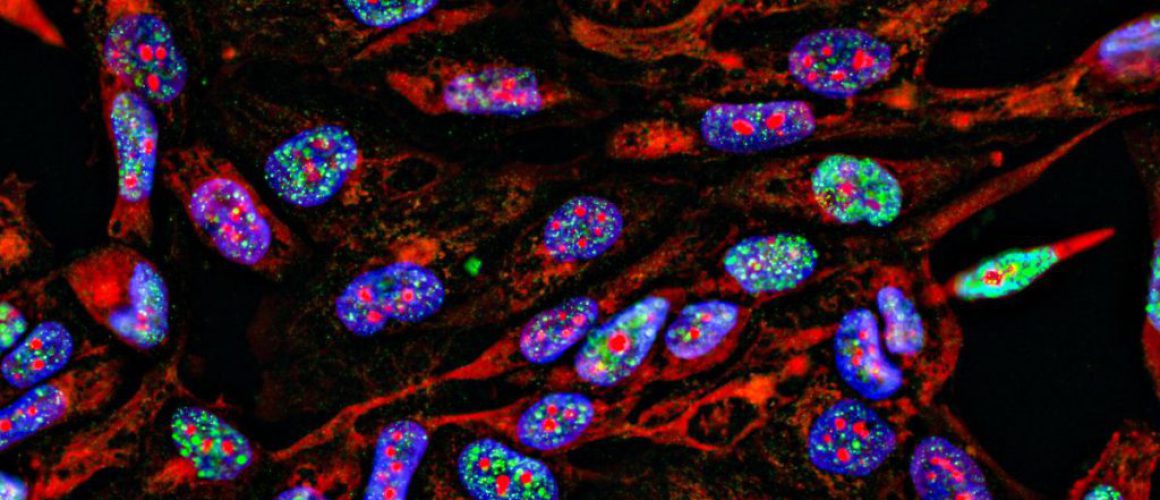 Immunofluorescence Staining Nasopharyngeal Carcinoma Cells